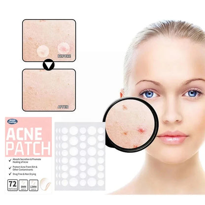 Acne and Pimple Removal And Spots Repair Stickers. - BLAKESTORE-NG