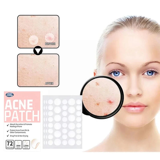 Acne and Pimple Removal And Spots Repair Stickers. - BLAKESTORE-NG