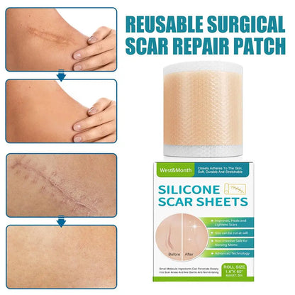 Acne And Burn Scar Sheet Patch Treatment. - BLAKESTORE-NG